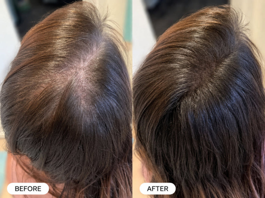 Glowlabs Repair Spray — Eliminates Thinning Hair