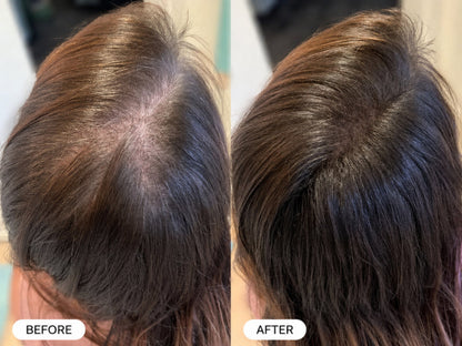 Glowlabs Repair Spray — Eliminates Thinning Hair