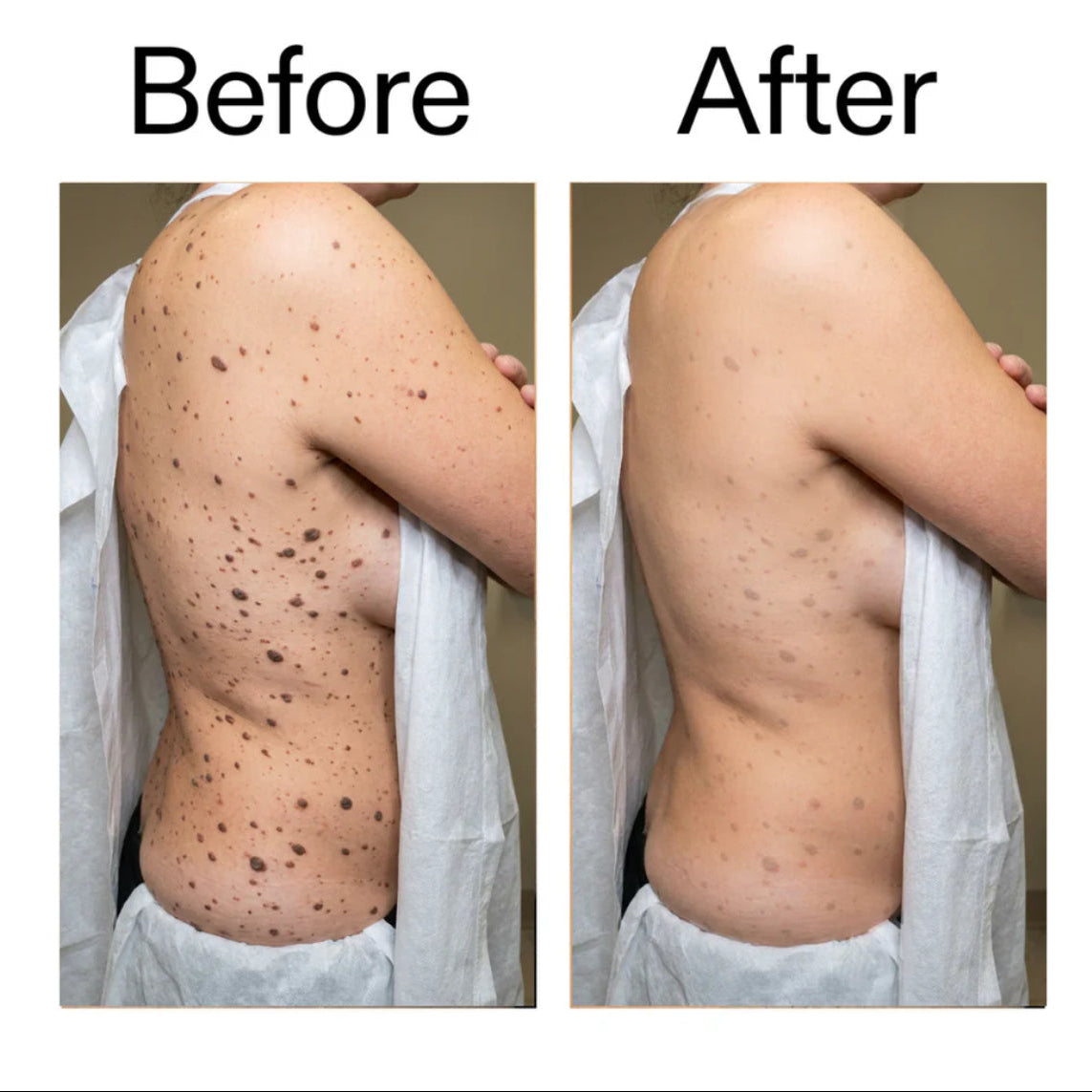Smooth & Even Glycolic Body Stick
